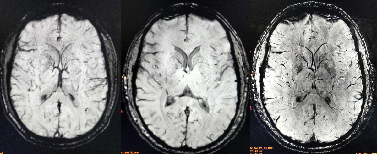 Brains at 1.5, 3, and 7 Tesla